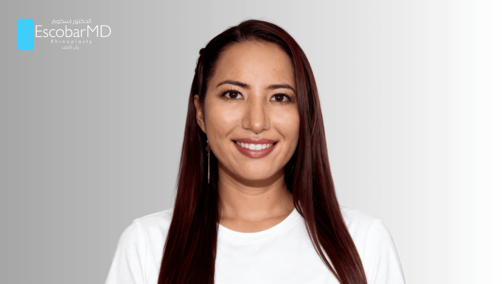 Ethnic Revision Rhinoplasty for Bulbous Nasal Tip in Dubai 7 REVISION RHINOPLASTY— Where Expertise Restores Confidence (9)